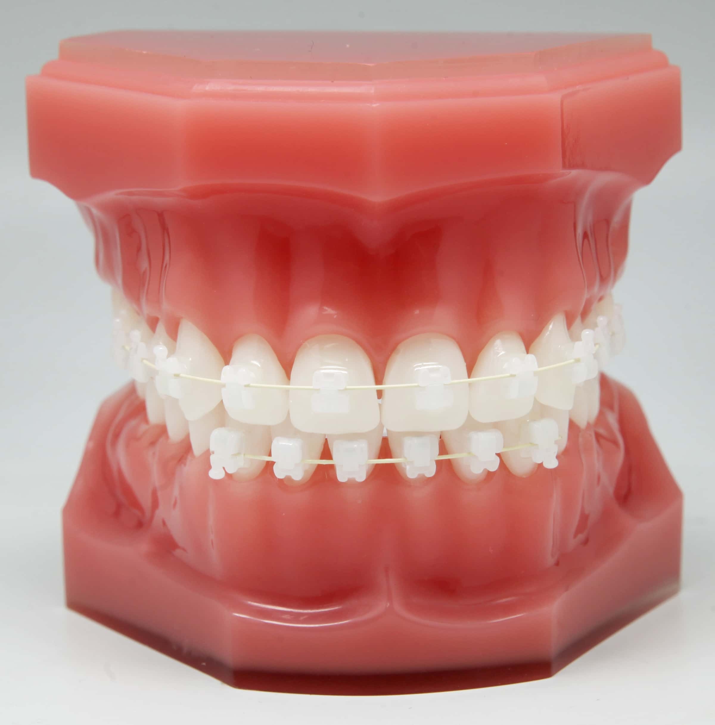 brace-image