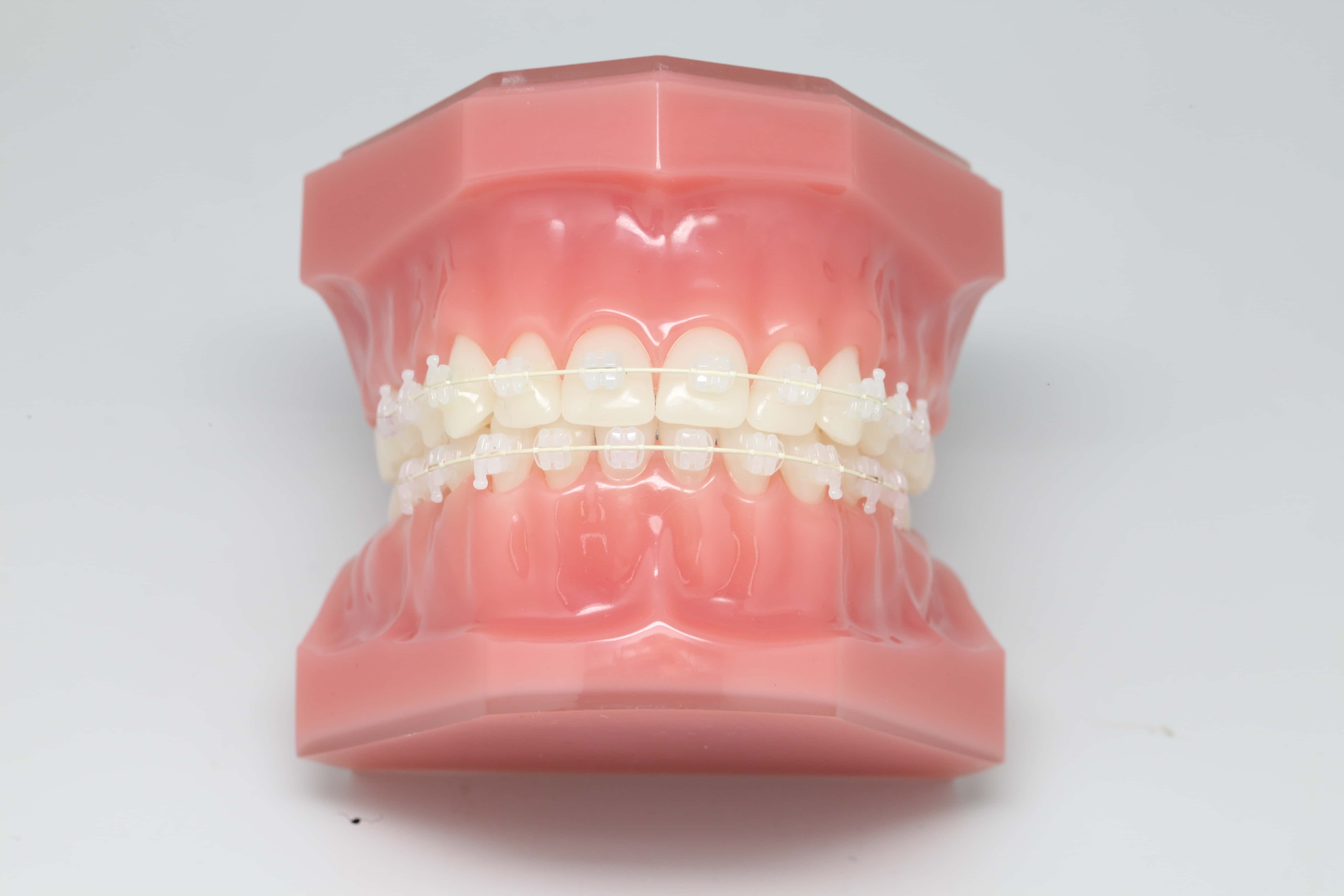 brace-image
